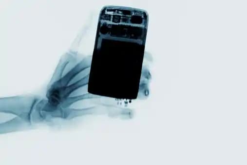 Cep Telefonları ve X-ışını Görüntüleri: Gerçeklik, Mümkünlük ve Sınırlar