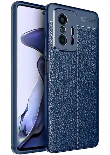 Xiaomi Mi 11T 5G Uyumlu Darbeye Dayanıklı Deri ve Silikon Kılıfın Özellikleri ve Kullanıcı Yorumları