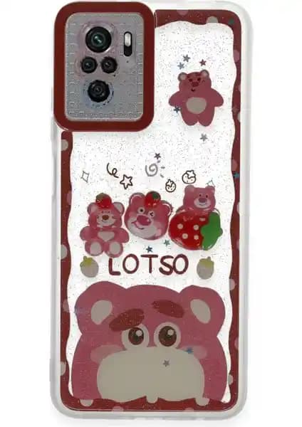 Redmi Note 10 İçin Şık ve Koruyucu Sweet Desenli Silikon Kılıf Özellikleri