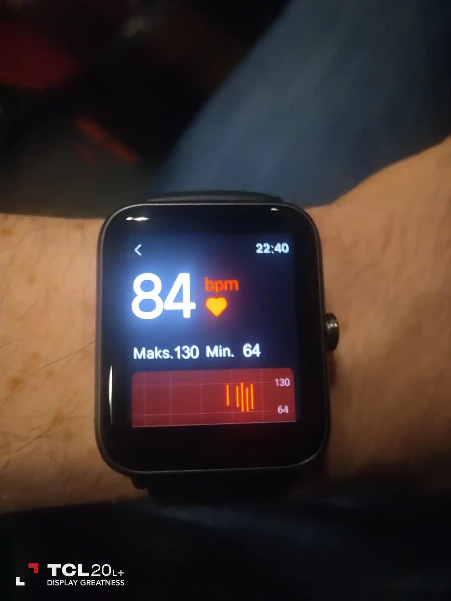 Vestel Akıllı Saat Şarj Süresi ve Batarya Yönetimi Hakkında Bilmeniz Gerekenler