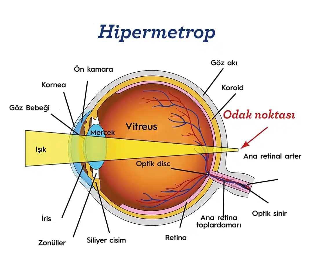 Gerçek Zamanlı Odak Ayarı Yapabilen Autofocus Gözlüklerin Teknolojisi ve Kullanım Zorlukları